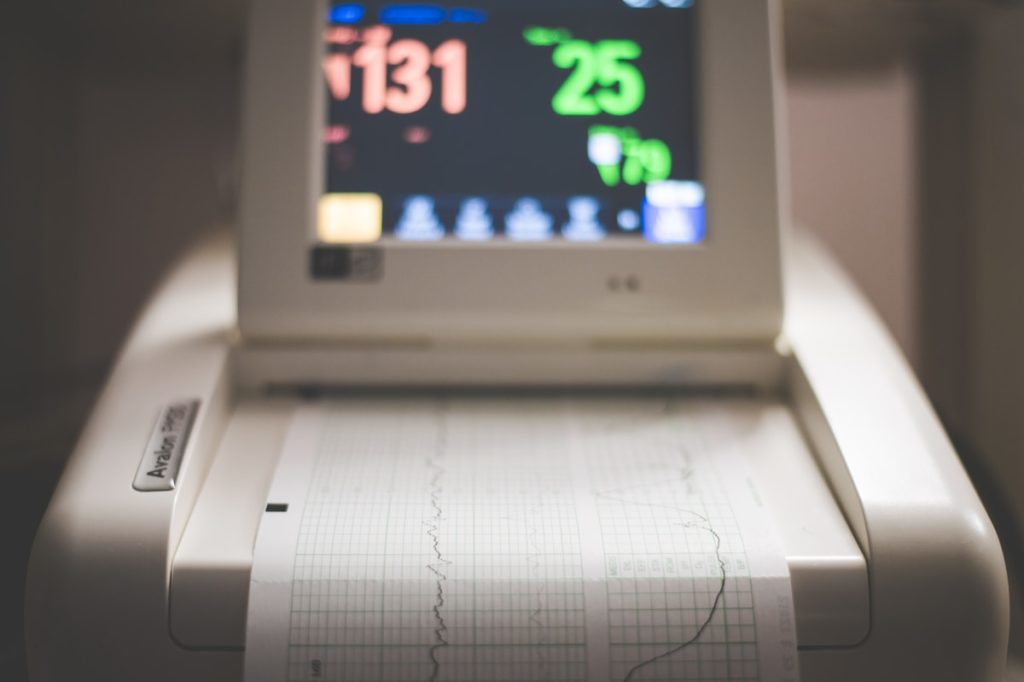 Equipo de electrocardiografía en Prestige M.C.